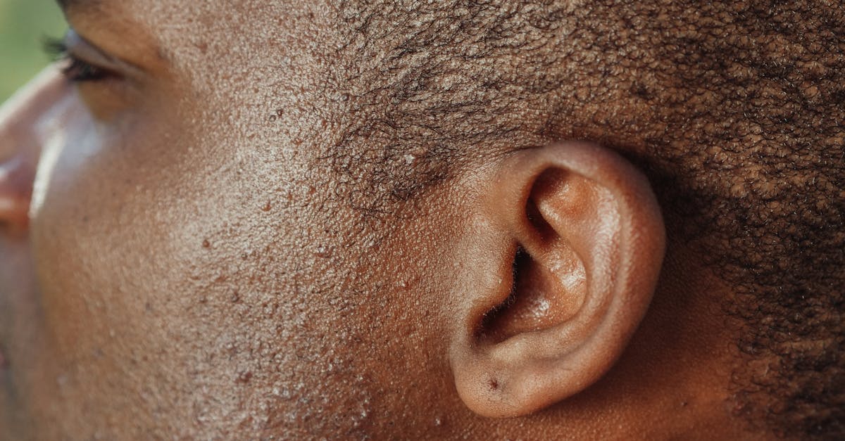 A Historical Overview of In-the-Canal (ITC) Hearing Aids